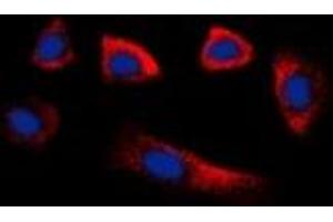 Immunofluorescent analysis of Glycerate Kinase staining in HepG2 cells. (GLYCTK antibody)