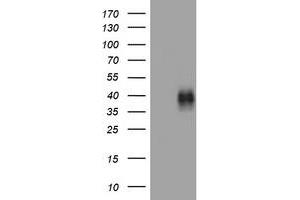 Image no. 1 for anti-Tumor Necrosis Factor Receptor Superfamily, Member 9 (TNFRSF9) (AA 24-186) antibody (ABIN1491247) (CD137 antibody  (AA 24-186))