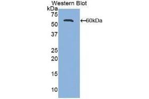 Detection of Recombinant ALCAM, Mouse using Polyclonal Antibody to Activated Leukocyte Cell Adhesion Molecule (ALCAM) (CD166 antibody  (AA 28-527))