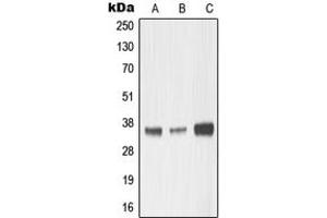 Western blot analysis of MMP23 expression in HepG2 (A), mouse kidney (B), rat kidney (C) whole cell lysates. (Matrix Metallopeptidase 23 (MMP23) (Center) antibody)