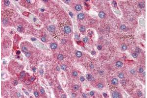 Liver: Formalin-Fixed, Paraffin-Embedded (FFPE) (HYAL1 antibody  (AA 325-339))