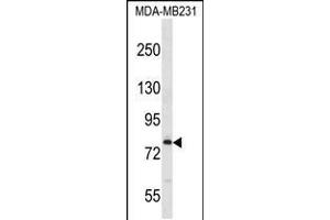 Western blot analysis in MDA-MB231 cell line lysates (35ug/lane). (MED17 antibody  (AA 332-361))