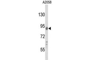 Western Blotting (WB) image for anti-Component of Oligomeric Golgi Complex 4 (COG4) antibody (ABIN3003206)