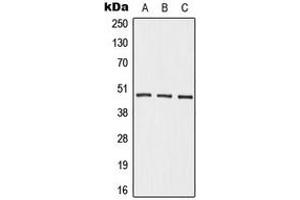 Western blot analysis of Beta-2 Adrenergic Receptor expression in HepG2 (A), mouse kidney (B), rat kidney (C) whole cell lysates. (beta 2 Adrenergic Receptor antibody  (C-Term))