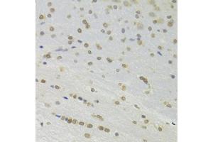 Immunohistochemistry (IHC) image for anti-Docking Protein 1, 62kDa (Downstream of tyrosine Kinase 1) (DOK1) (AA 1-280) antibody (ABIN6139763)