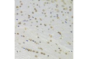 Immunohistochemistry of paraffin-embedded rat brain using DOK1 Antibody (ABIN6130881, ABIN6139763, ABIN6139764 and ABIN6221343) at dilution of 1:100 (40x lens). (DOK1 antibody  (AA 1-280))