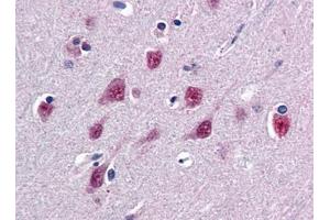 Image no. 1 for anti-Single-Strand-Selective Monofunctional Uracil-DNA Glycosylase 1 (SMUG1) (N-Term) antibody (ABIN372862) (SMUG1 antibody  (N-Term))