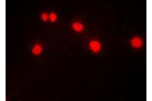 Immunofluorescent analysis of DYRK1A staining in HeLa cells. (DYRK1A antibody  (N-Term))