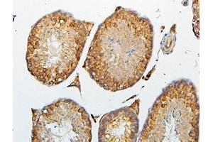 IHC analysis of CRB1 using anti-CRB1 antibody (ABIN6719658). (CRB1 antibody)