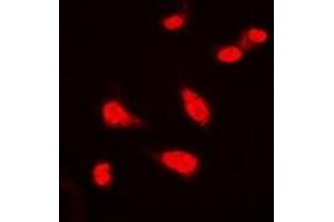 Immunofluorescent analysis of BAP1 staining in Hela cells. (BAP1 antibody)