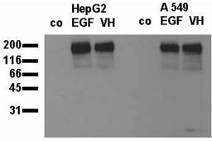 Phosphospecificity: Whole cell extracts of control (co), EGF stimulated (EGF) or pervanadate treated (VH) HepG2 and A549 tumor cells were applied to SDS-PAGE (20,000 cells per lane) and transferred to a PVDF membrane. (EGFR antibody  (pTyr845))