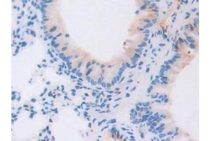Immunohistochemistry (IHC) image for anti-Interleukin 6 Signal Transducer (Gp130, Oncostatin M Receptor) (IL6ST) (AA 238-500) antibody (ABIN7430555)