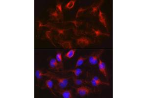 Immunofluorescence analysis of U-251MG cells using METTL7B Rabbit pAb (ABIN6128288, ABIN6143779, ABIN6143781 and ABIN6223026) at dilution of 1:100 (40x lens).
