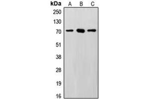 Western blot analysis of SENP3 expression in HeLa (A), MCF7 (B), Saos2 (C) whole cell lysates. (SENP3 antibody  (N-Term))
