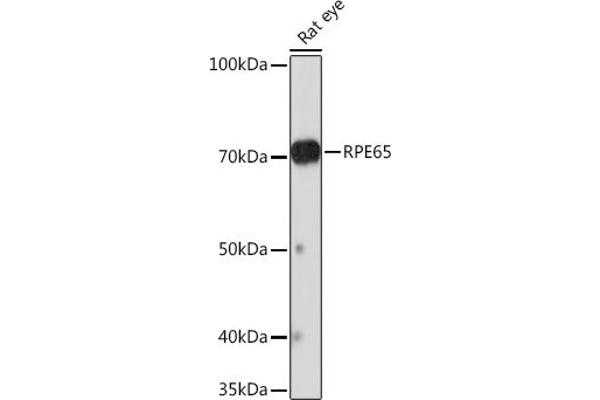 RPE65 antibody