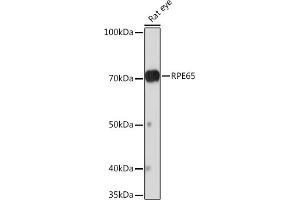 Western blot analysis of extracts of Rat eye, using RPE65 Rabbit mAb (ABIN7269933) at 1:1000 dilution.