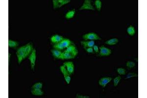 Immunofluorescent analysis of Hela cells using ABIN7165534 at dilution of 1:100 and Alexa Fluor 488-congugated AffiniPure Goat Anti-Rabbit IgG(H+L) (FAM71A antibody  (AA 381-594))