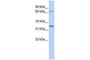 SLCO1C1 antibody  (N-Term)
