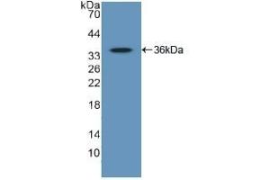 Detection of Recombinant GATA2, Human using Polyclonal Antibody to GATA Binding Protein 2 (GATA2) (GATA2 antibody  (AA 175-480))