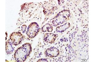 Formalin-fixed and paraffin embedded rat colitis tissue labeled with Anti CD98 Polyclonal Antibody, Unconjugated  at 1:200 followed by conjugation to the secondary antibody and DAB staining (SLC3A2 antibody  (AA 231-280))