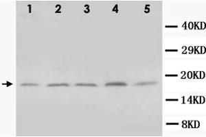 Western Blot analysis of BCL2L1 expression from cell extracts with BCL2L1 polyclonal antibody . (BCL2L1 antibody  (Internal Region))