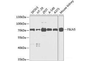 Western blot analysis of extracts of various cell lines using FBLN5 Polyclonal Antibody at dilution of 1:1000. (Fibulin 5 antibody)