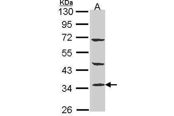 PTER antibody