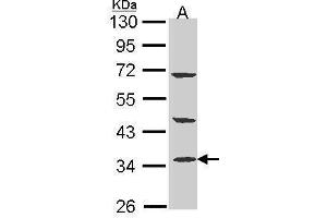 WB Image Sample (30 ug of whole cell lysate) A: A431 , 10% SDS PAGE antibody diluted at 1:1000 (PTER antibody)
