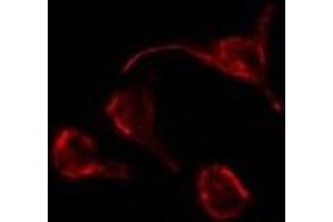 ABIN6276852 staining Hela by IF/ICC. (PTH1R antibody  (pThr1))