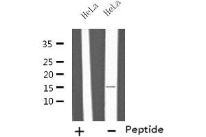 Western blot analysis of extracts from HeLa cells, using IL4 antibody. (IL-4 antibody  (Internal Region))