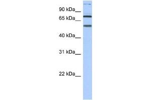 WB Suggested Anti-DLL4 Antibody Titration: 0. (DLL4 antibody  (N-Term))