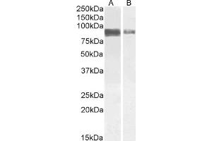 ABIN5539499 (1 μg/mL) staining of Jurkat (A) and (2 μg/mL) A431 (B) cell lysate (35 μg protein in RIPA buffer). (CRTC2 antibody  (C-Term))