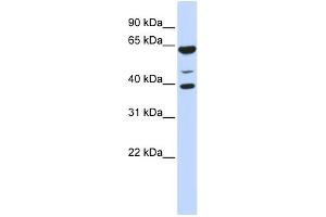 WB Suggested Anti-ZNF764 Antibody Titration: 0. (ZNF764 antibody  (N-Term))
