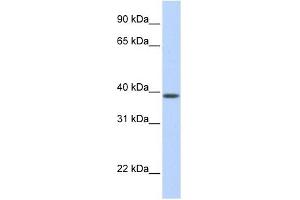 SLC25A42 antibody used at 1 ug/ml to detect target protein. (SLC25A42 antibody  (N-Term))