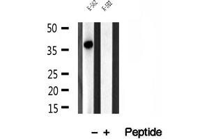 Western blot analysis of extracts of K-562 cells, using SGTA antibody. (SGTA antibody  (C-Term))