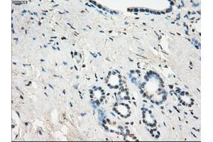 Immunohistochemical staining of paraffin-embedded Ovary tissue using anti-GBP2mouse monoclonal antibody. (GBP2 antibody)