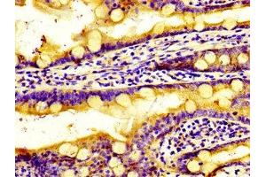 Immunohistochemistry of paraffin-embedded human small intestine tissue using ABIN7170569 at dilution of 1:100