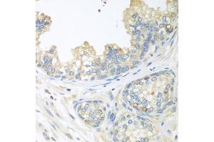 Immunohistochemistry of paraffin-embedded human prostate using CUL3 antibody (ABIN5970436) at dilution of 1/100 (40x lens). (Cullin 3 antibody)