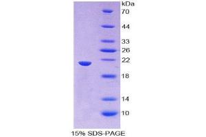 SDS-PAGE (SDS) image for Thimet Oligopeptidase 1 (THOP1) (AA 451-597) protein (His tag) (ABIN2126942)