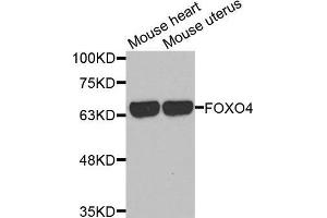 Western blot analysis of extracts of various cell lines, using FOXO4 antibody. (FOXO4 antibody  (AA 346-505))