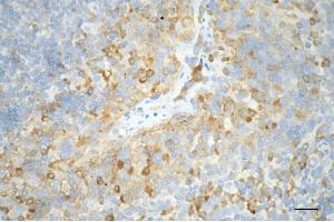 Immunohistochemistry was performed on paraffin-embedded human tonsillitis using caspase 3 antibody (ABIN7797893), 1:200).