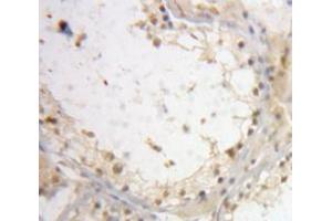 IHC-P analysis of Testis tissue, with DAB staining. (Interleukin enhancer-binding factor 3 (ILF3) (AA 672-891) antibody)