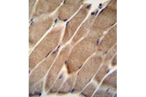 Formalin fixed and paraffin embedded human skeletal muscle reacted with ELMO2 Antibody  followed by peroxidase conjugation of the secondary antibody and DAB staining. (ELMO2 antibody  (Middle Region))