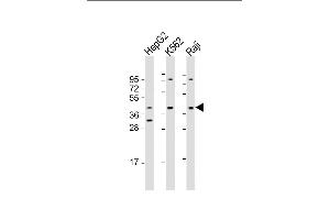 All lanes : Anti-FGFR1OP Antibody (Center) at 1:1000-1:2000 dilution Lane 1: HepG2 whole cell lysate Lane 2: K562 whole cell lysate Lane 3: Raji whole cell lysate Lysates/proteins at 20 μg per lane.
