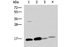 Western blot analysis of Human sigmoid tissue Mouse large intestine tissue Mouse small intestines tissue Mouse Pancreas tissue lysates using ZG16 Polyclonal Antibody at dilution of 1:800 (ZG16 antibody)