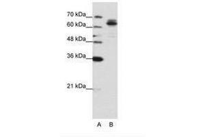 Image no. 1 for anti-Fragile X Mental Retardation, Autosomal Homolog 1 (FXR1) (AA 373-422) antibody (ABIN6736201) (FXR1 antibody  (AA 373-422))