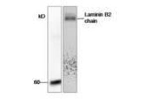 Image no. 1 for anti-Laminin, gamma 1 (LAMC1) (AA 526-1106) antibody (ABIN791436) (Laminin gamma 1 antibody  (AA 526-1106))