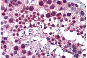 Human Testis: Formalin-Fixed, Paraffin-Embedded (FFPE) (PLK1 antibody  (C-Term))
