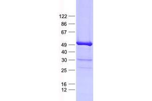 Validation with Western Blot (LIM Domain Binding 2 Protein Protein (His tag))