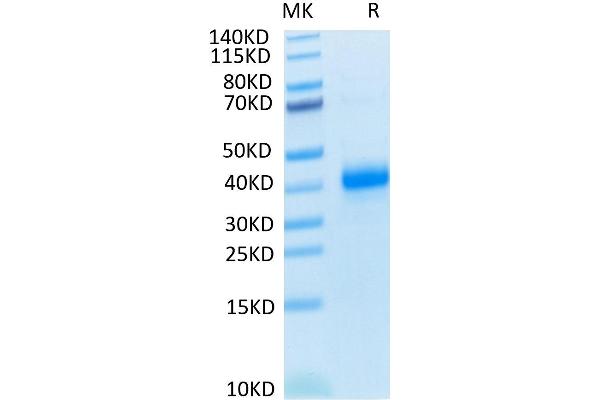 CD2 Protein (CD2) (His tag)